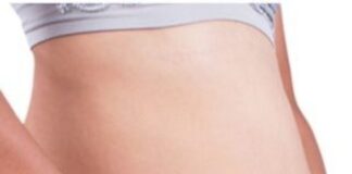 Home remedy for bloated stomach_ Different people…